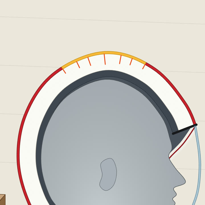 Helm SNI, dibedah